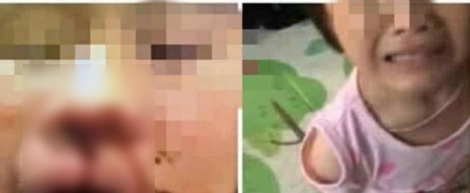 Mẹ đi lao động xa, con ở nhà bị bố đánh đập nhiều lần tại Hưng Yên